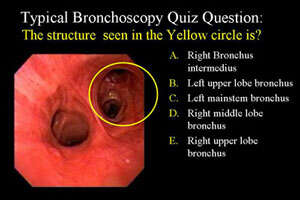 bronchoscopy quiz