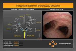 bronchoscopy simulator